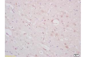 Formalin-fixed and paraffin embedded rat brain labeled with Anti-ST18/Znf387 Polyclonal Antibody, Unconjugated (ABIN1386039) at 1:200 followed by conjugation to the secondary antibody and DAB staining (ST18 anticorps  (AA 451-550))