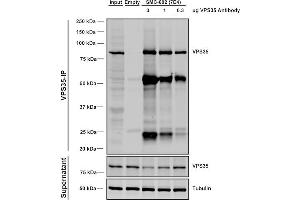 Immunoprecipitation analysis using Mouse Anti-VPS35 Monoclonal Antibody, Clone 7E4 (ABIN6932908). (VPS35 anticorps)
