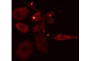 ABIN6275105 staining Hela cells by IF/ICC. (ELOVL1 anticorps  (Internal Region))