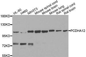 Western blot analysis of extracts of various cell lines, using PCDHA12 antibody. (PCDHA12 anticorps)