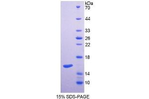 SDS-PAGE (SDS) image for serine Palmitoyltransferase, Long Chain Base Subunit 2 (SPTLC2) (AA 453-560) protein (His tag) (ABIN6237536)