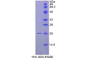 SDS-PAGE analysis of Human MYL9 Protein.