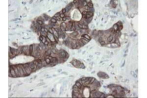 Image no. 6 for anti-Prefoldin Subunit 3 (PFDN3) antibody (ABIN1501702)