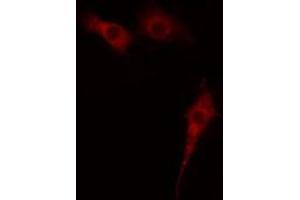 ABIN6274400 staining Hela cells by IF/ICC.