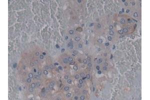 Detection of CDNF in Rat Adrenal gland Tissue using Polyclonal Antibody to Cerebral Dopamine Neurotrophic Factor (CDNF)