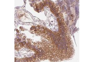 AMPK1 Antibody for IHC in human gallbladder tissue (PRKAA1 anticorps  (C-Term))