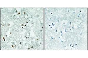 Immunohistochemistry analysis of paraffin-embedded human brain, using ELAC2 Antibody. (ELAC2 anticorps  (AA 161-210))