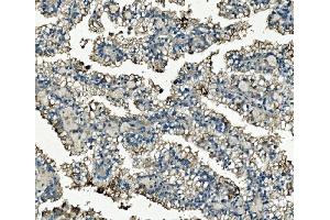 IHC analysis of Clathrin heavy chain/CLTC using anti-Clathrin heavy chain/CLTC antibody (ABIN7602703). (Clathrin Heavy Chain (CLTC) (AA 967-1668) anticorps)