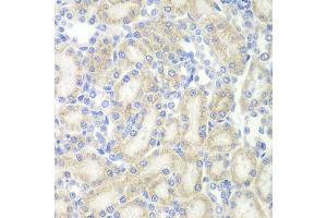 Immunohistochemistry of paraffin-embedded rat kidney using MAP2 antibody (ABIN5970171) at dilution of 1/200 (40x lens). (MAP2 anticorps)