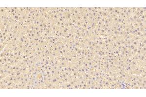 Detection of ARG in Rat Liver Tissue using Polyclonal Antibody to Arginase (ARG)