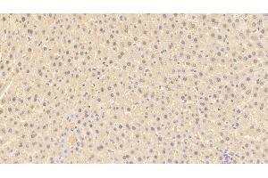 Detection of ARG in Rat Liver Tissue using Polyclonal Antibody to Arginase (ARG) (ARG anticorps  (AA 1-323))