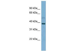 WB Suggested Anti-MARCH8 Antibody Titration:  0. (MARCH8 anticorps  (N-Term))
