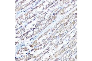 Immunohistochemistry of paraffin-embedded rat stomach using TRPV6 Rabbit pAb (ABIN7270921) at dilution of 1:100 (40x lens).