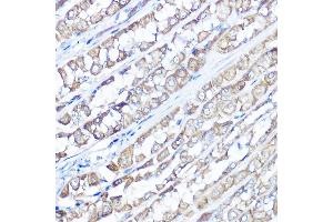 Immunohistochemistry of paraffin-embedded rat stomach using TRPV6 Rabbit pAb (ABIN7270921) at dilution of 1:100 (40x lens). (TRPV6 anticorps  (AA 1-100))