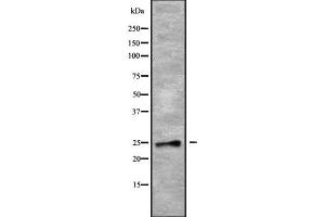 Western blot analysis of RAB28 using COLO205 whole cell lysates (RAB28 anticorps  (Internal Region))