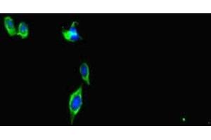 Immunofluorescent analysis of Hela cells using ABIN7147403 at dilution of 1:100 and Alexa Fluor 488-congugated AffiniPure Goat Anti-Rabbit IgG(H+L) (CEP290 anticorps  (AA 86-156))