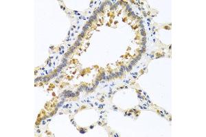 Immunohistochemistry of paraffin-embedded rat lung using CPA1 antibody at dilution of 1:100 (40x lens). (CPA1 anticorps)