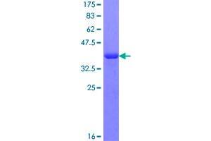Image no. 1 for RAB GTPase Activating Protein 1-Like (RABGAP1L) (AA 1-110) protein (GST tag) (ABIN1317234)