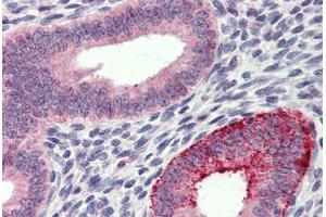 Uterus, Human: Formalin-Fixed, Paraffin-Embedded (FFPE)