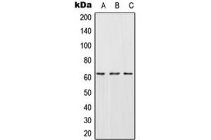 Western blot analysis of CES2 expression in HepG2 (A), SP2/0 (B), H9C2 (C) whole cell lysates. (CES2 anticorps  (Center))