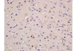 Formalin-fixed and paraffin embedded rat brain labeled with Rabbit Anti-SOD1 Polyclonal Antibody, Unconjugated  at 1:200 followed by conjugation to the secondary antibody and DAB staining (SOD1 anticorps  (AA 6-100))