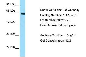 Western Blotting (WB) image for anti-APC Membrane Recruitment Protein 2 (AMER2) (N-Term) antibody (ABIN2786237) (AMER2 anticorps  (N-Term))