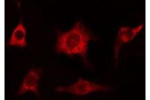 ABIN6274993 staining HeLa cells by IF/ICC. (CEP78 anticorps  (Internal Region))