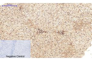 Immunohistochemical analysis of paraffin-embedded human liver tissue. (Cadherin 5 anticorps  (Internal Region))