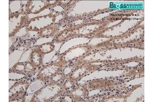 Formalin-fixed and paraffin embedded horse kidney labeled with Anti- HSD11B2 Polyclonal Antibody, Unconjugated at 1:200 followed by conjugation to the secondary antibody and DAB staining (HSD11B2 anticorps  (AA 151-250))