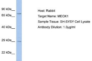 Host: Rabbit Target Name: MEOX1 Sample Tissue: Human SH-SYSY Whole Cell  Antibody Dilution: 1ug/ml (MEOX1 anticorps  (C-Term))