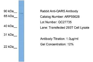 Western Blotting (WB) image for anti-Glutaminyl-tRNA Synthetase (QARS) (N-Term) antibody (ABIN2786804) (QARS anticorps  (N-Term))