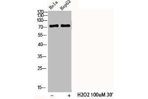 Western Blot analysis of HELA HepG2 cells using Phospho-Cortactin (Y466) Polyclonal Antibody (Cortactin anticorps  (pTyr466))