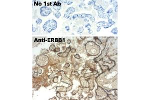 Immunohistochemistry (IHC) image for anti-Epidermal Growth Factor Receptor (EGFR) (C-Term) antibody (ABIN6254171) (EGFR anticorps  (C-Term))