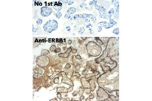 Immunohistochemistry (IHC) image for anti-Epidermal Growth Factor Receptor (EGFR) (C-Term) antibody (ABIN6254171)