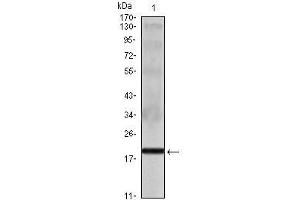 Western Blot showing IL16 antibody used against IL16 recombinant protein.