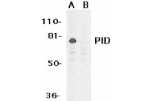 Image no. 1 for anti-Metastasis Associated 1 Family, Member 2 (MTA2) (AA 652-668) antibody (ABIN265128) (MTA2 anticorps  (AA 652-668))