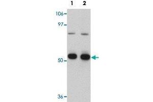 Western blot analysis of K-562 cells with CDC23 polyclonal antibody  at (Lane 1) 1 and (Lane 2) 2 ug/mL dilution. (CDC23 anticorps  (Internal Region))