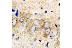 Immunohistochemistry (IHC) image for anti-Ribosomal Protein, Large, p1 (RPLP1) antibody (ABIN7308288)