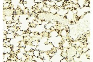 ABIN6275531 at 1/100 staining Mouse lung tissue by IHC-P. (NEK7 anticorps  (Internal Region))