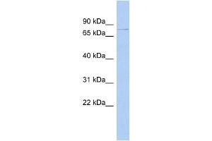DHX58 antibody used at 1 ug/ml to detect target protein. (DHX58 anticorps)