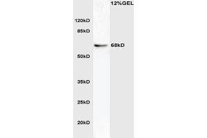 L1 mouse brain lysate probed with Anti phospho-ATG16A(Ser287) Polyclonal Antibody, Unconjugated  at 1:3000 for 90 min at 37˚C. (ATG16L1 anticorps  (pSer287))