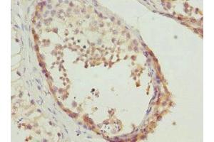 Immunohistochemistry of paraffin-embedded human testis tissue using ABIN7150790 at dilution of 1:100 (TESK2 anticorps  (AA 302-571))