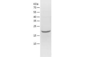 Western Blotting (WB) image for Regulator of G-Protein Signaling 16 (RGS16) (AA 1-202) protein (His-IF2DI Tag) (ABIN7124815)