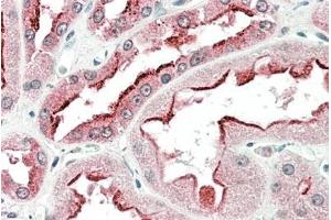 ABIN625824 (5µg/ml) staining of paraffin embedded Human Kidney.