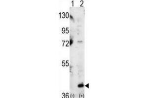 Western Blotting (WB) image for anti-Mitogen-Activated Protein Kinase 14 (MAPK14) antibody (ABIN3003280) (MAPK14 anticorps)