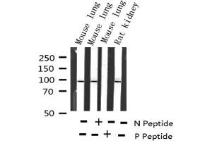 Western blot analysis of Phospho-STAT6 (Thr645) expression in various lysates (STAT6 anticorps  (pThr645))