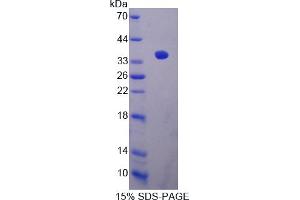 Image no. 1 for Sirtuin 4 (SIRT4) (AA 28-314) protein (His tag) (ABIN6237075)