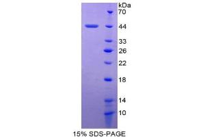 SDS-PAGE (SDS) image for gamma-Interferon-Induced Monokine (CXCL9) (AA 23-125) protein (His tag,GST tag) (ABIN1981026)