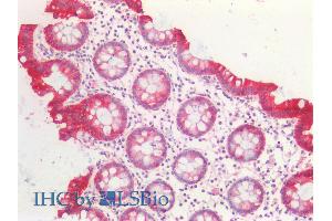 ABIN5539706 (5µg/ml) staining of paraffin embedded Human Colon.