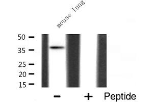 Western blot analysis of hnRNP A2/B1 expression in Mouse lung lysate (HNRNPA2B1 anticorps  (N-Term))